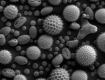 Пыльца растений. Вид под электронным микроскопом. Пыльца растений является одним из наиболее распространённых аллергенов окружающей среды